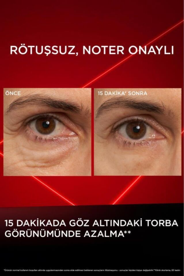 Loreal Paris Revitalift Lazer Eyebag Instant Eraser Göz Altı Torba Görünümüne Karşı Etkili Göz Kremi 15ml