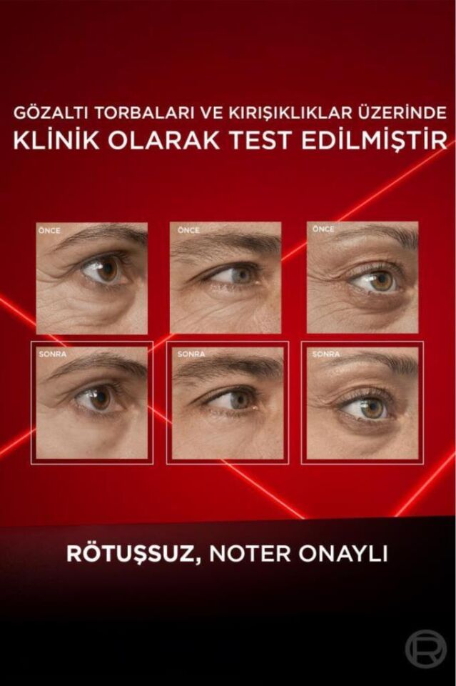 Loreal Paris Revitalift Lazer Eyebag Instant Eraser Göz Altı Torba Görünümüne Karşı Etkili Göz Kremi 15ml