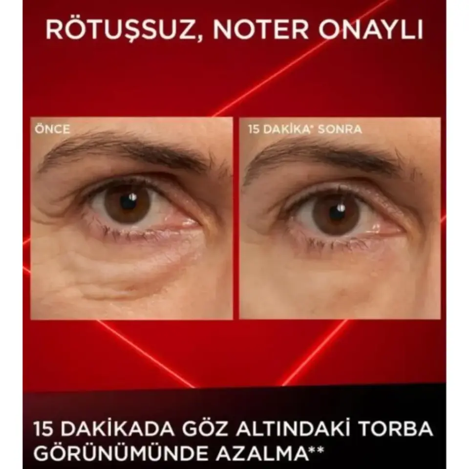 Loreal Paris Revitalift Göz Altı Torbası Karşıtı Göz Kremi 15 ml