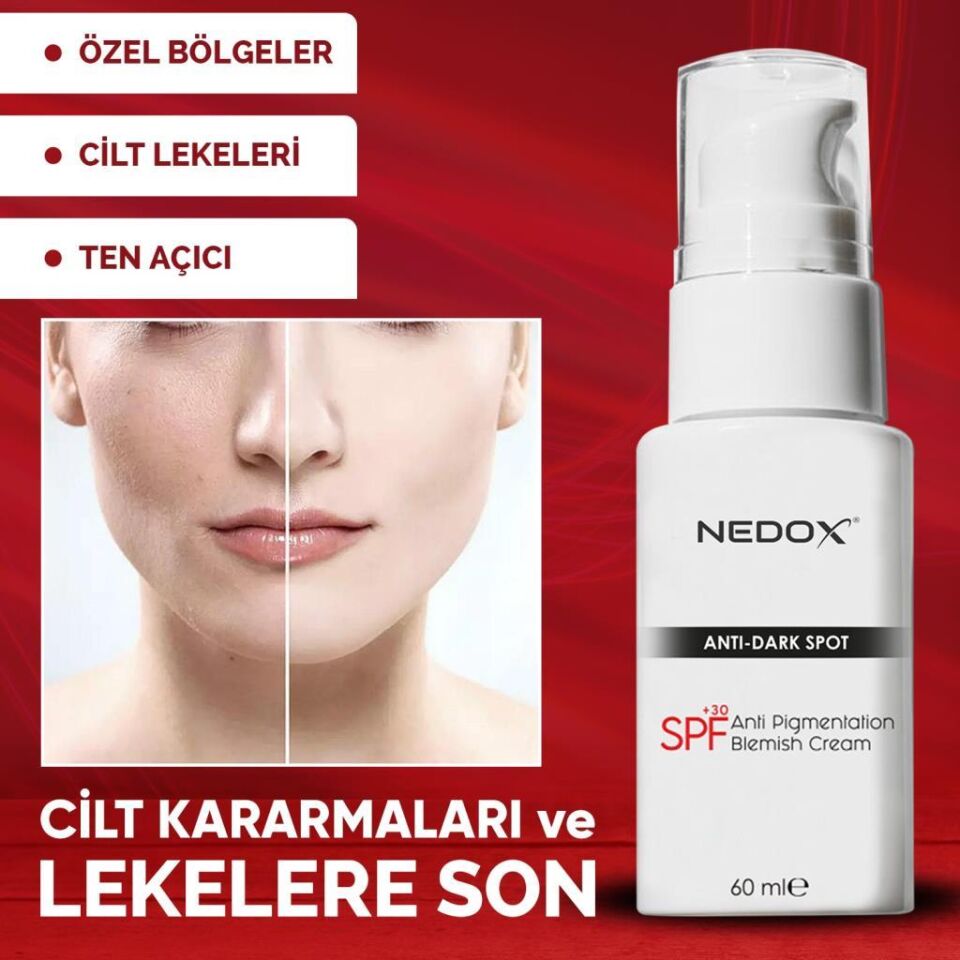 NEDOX Cilt Beyazlatıcı Leke Kremi 60 Ml