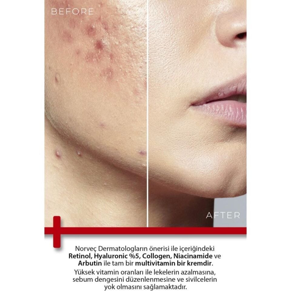 TODAYS CLİNİCALS Onarıcı Krem - Retinol Shea Butter Hyaluronic Acıd %5 Collagen % 2 Arbutin % 2
